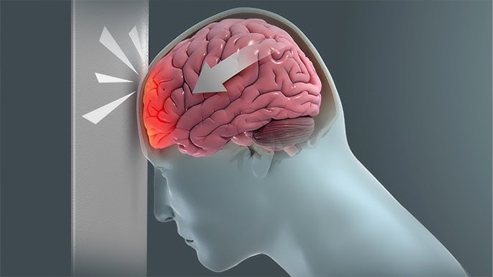 Head & Brain Injury Care